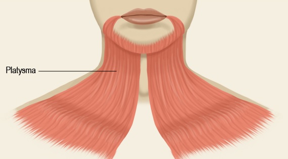 platysma muscle for neck lift in San Francisco