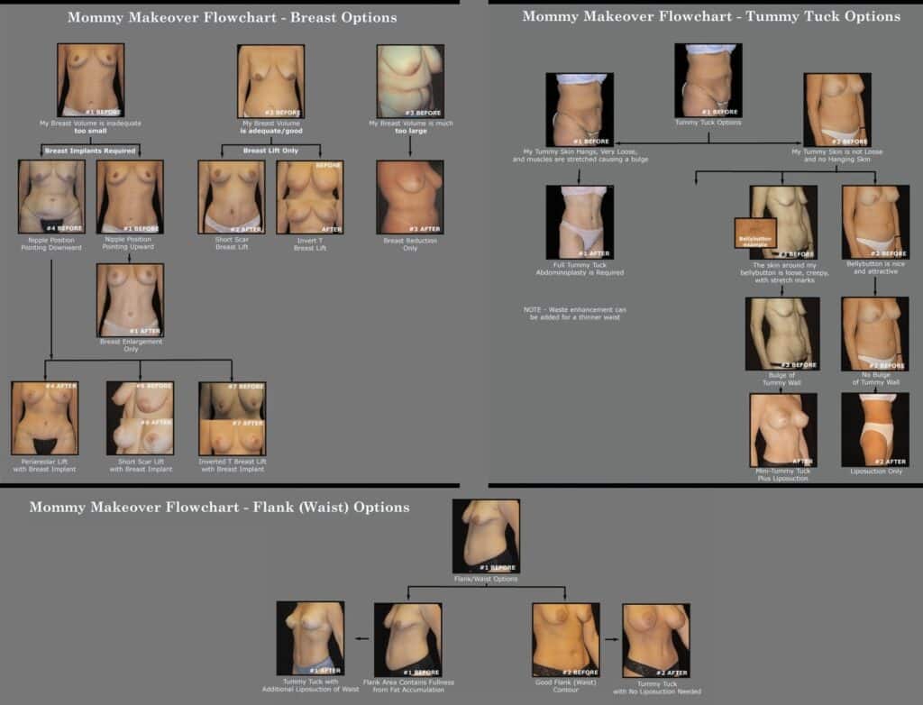 Recovery Differences by Procedure Type