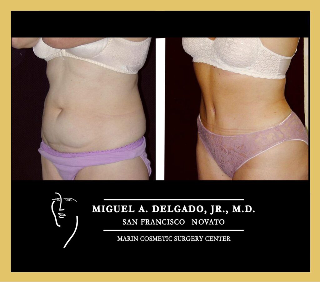 Before and after patient results 1