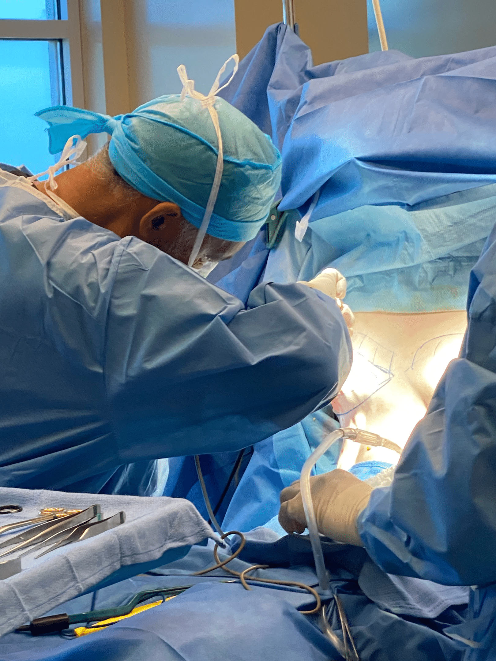 Dr Delgado operating in his surgery center -Marin Cosmetic Surgery Center near Greenbrae.