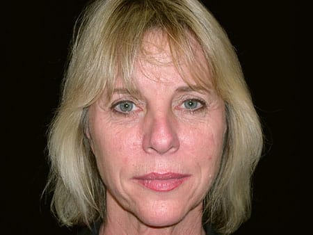 Janice Nunize, a patient of Dr. Delgado.