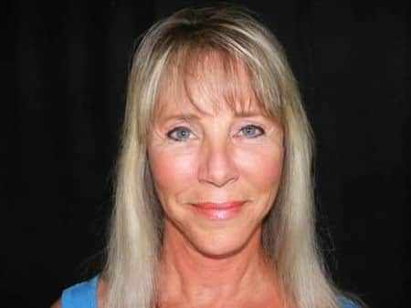 Janice 10 years after her deep plane facelift.