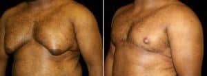 Before and after results
