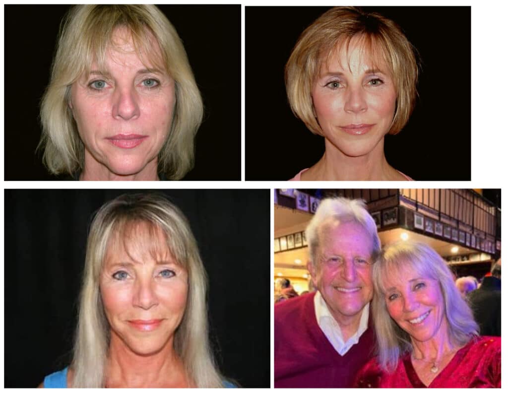Actual patient results