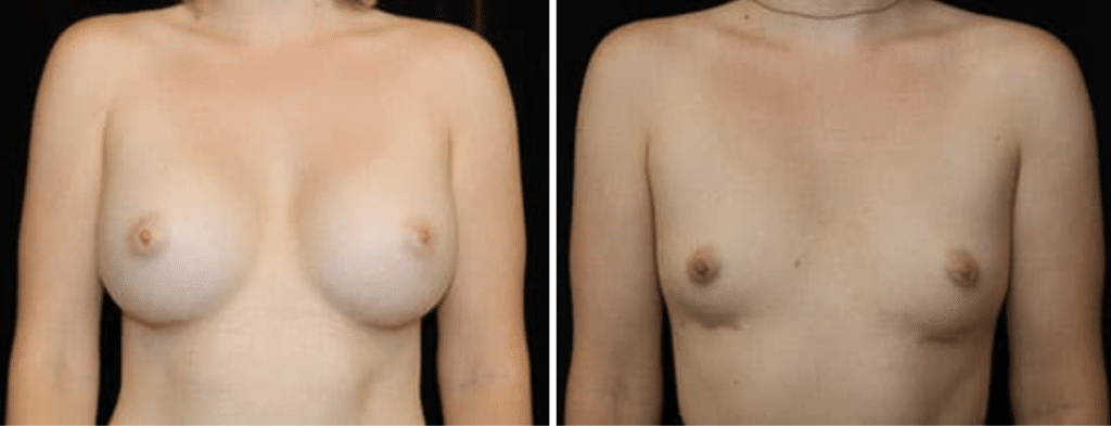 Patient Results